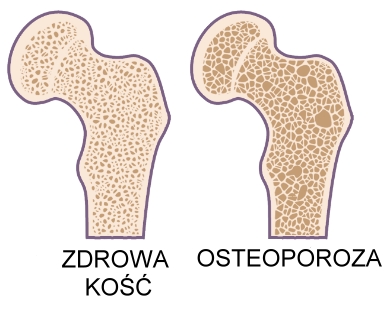 regenerację kości i leczenie osteoporozy